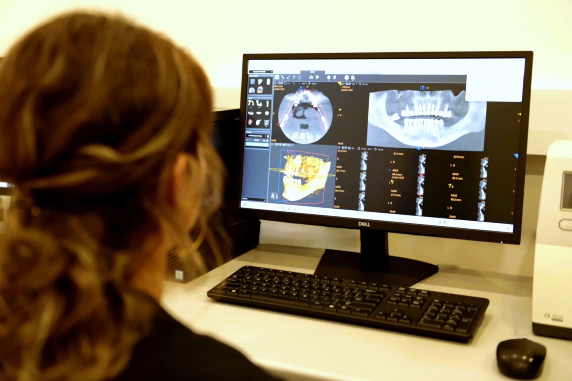 Asistenta de radiologie privește pe monitor secțiunile unei tomografii dentare, în laboratorul de radiologie